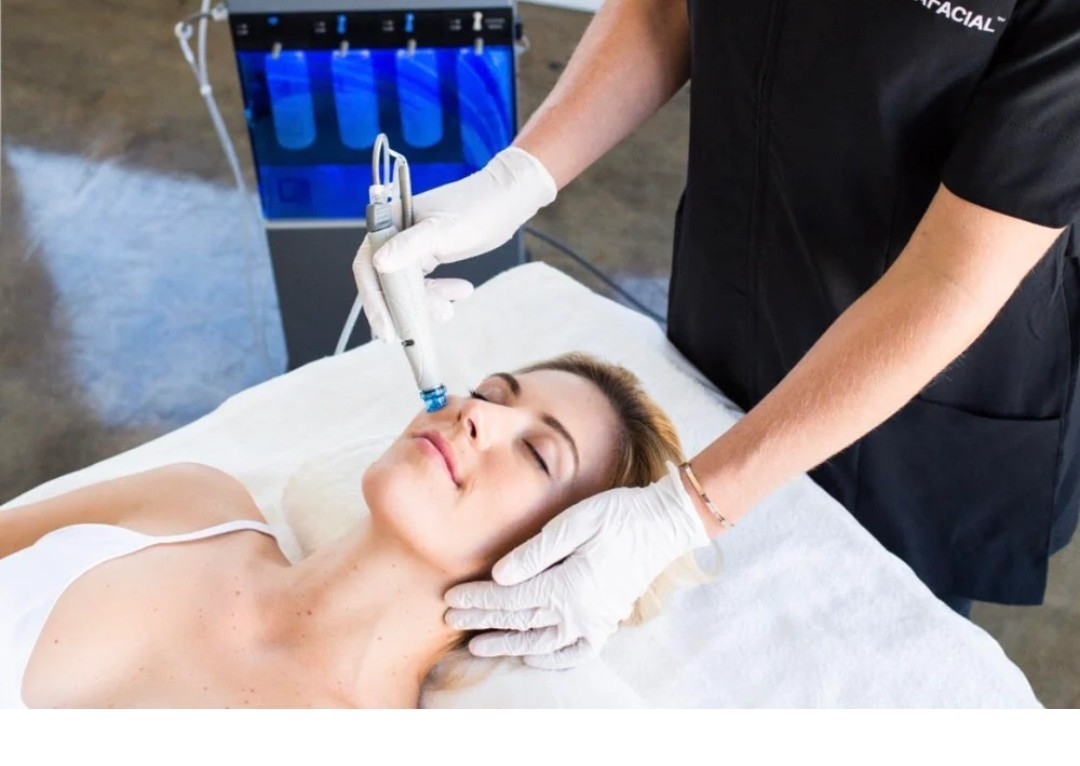 Black Peeling  X 4 sesiones 