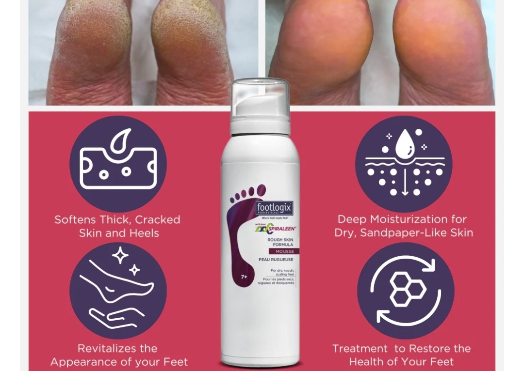 Footlogix (Rough Skin) 