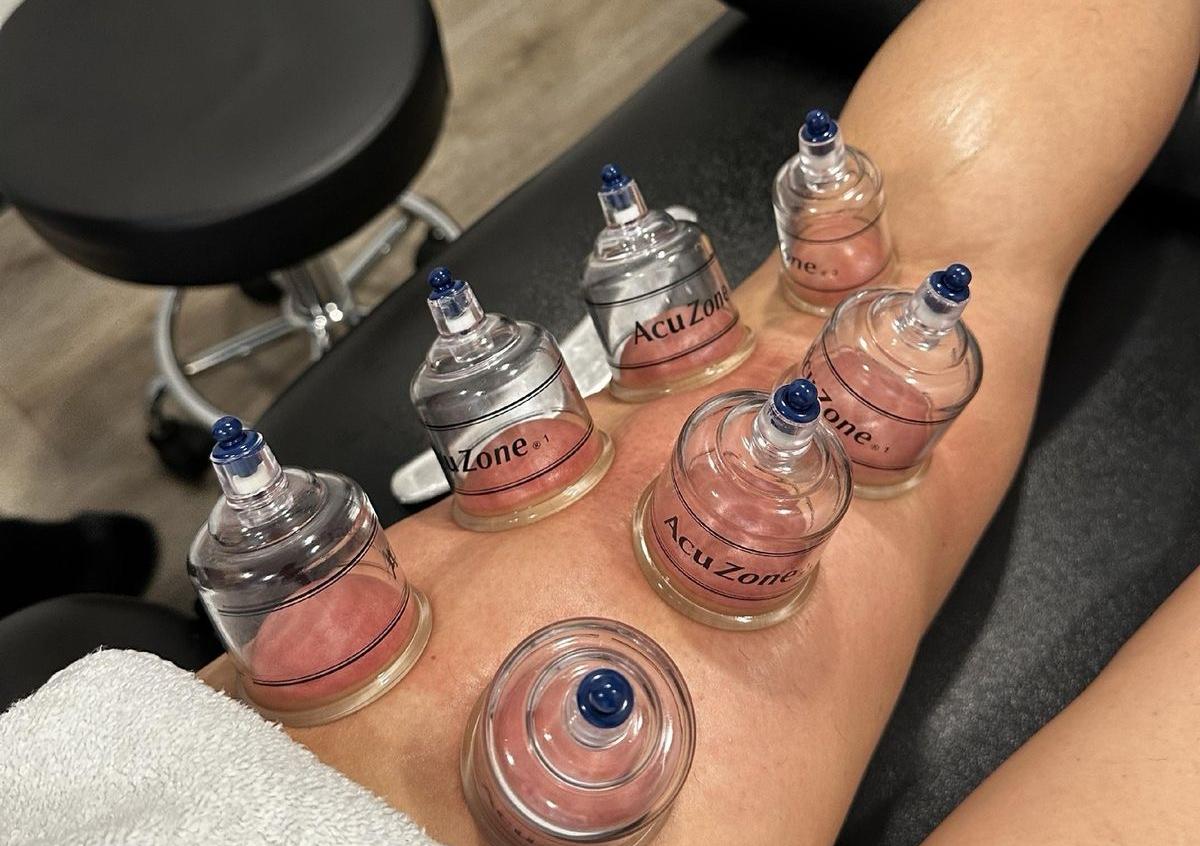 Cupping massage 