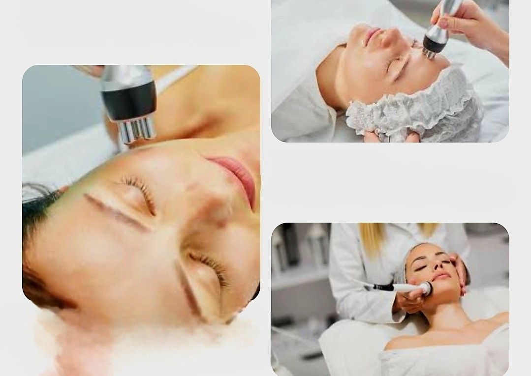 Facial & Chin  Radio Frequency  