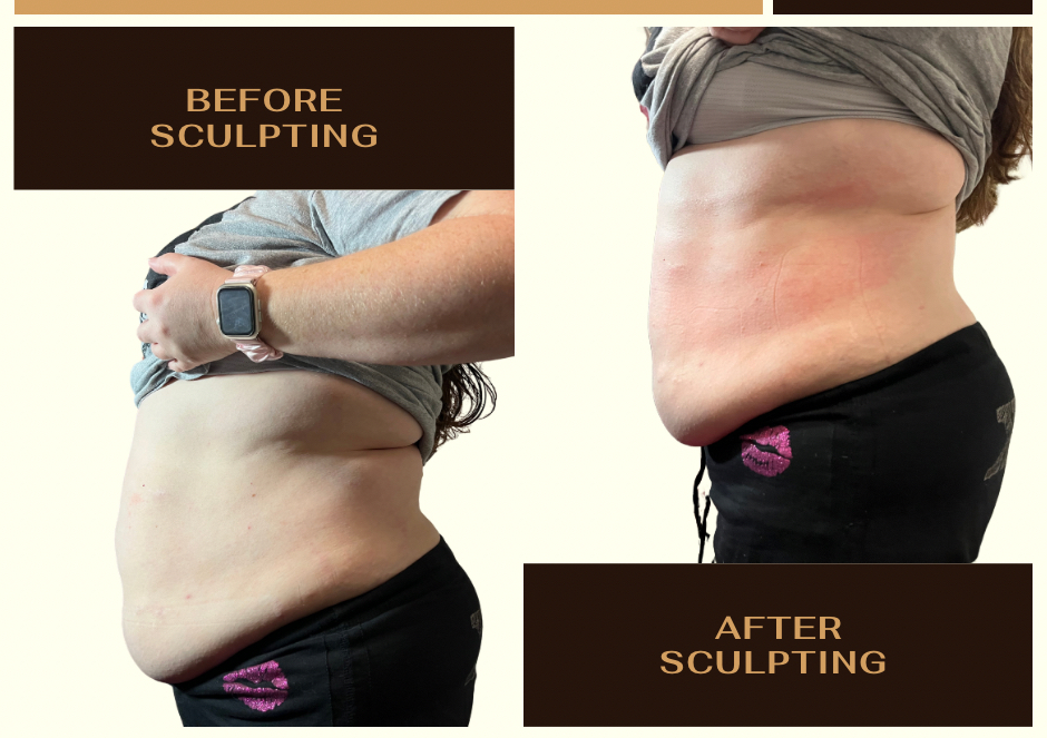 Hourglass Collection (4 Stomach/4 BBL) 