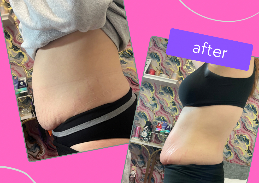 The Diamond Snatch (6 Stomach)