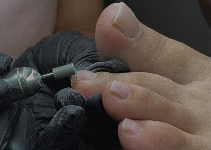 Gel Polish Removal Toes