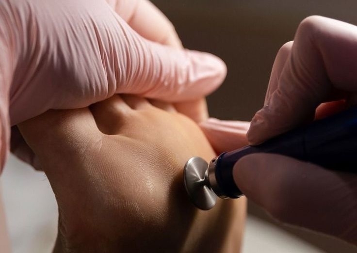 Classic Pedicure W|Callus Removal Treatment 