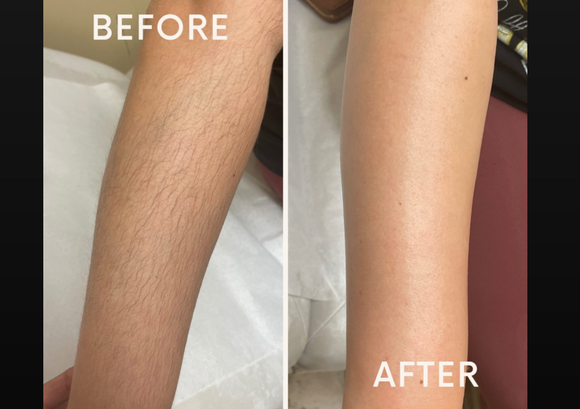 Full Arm Wax