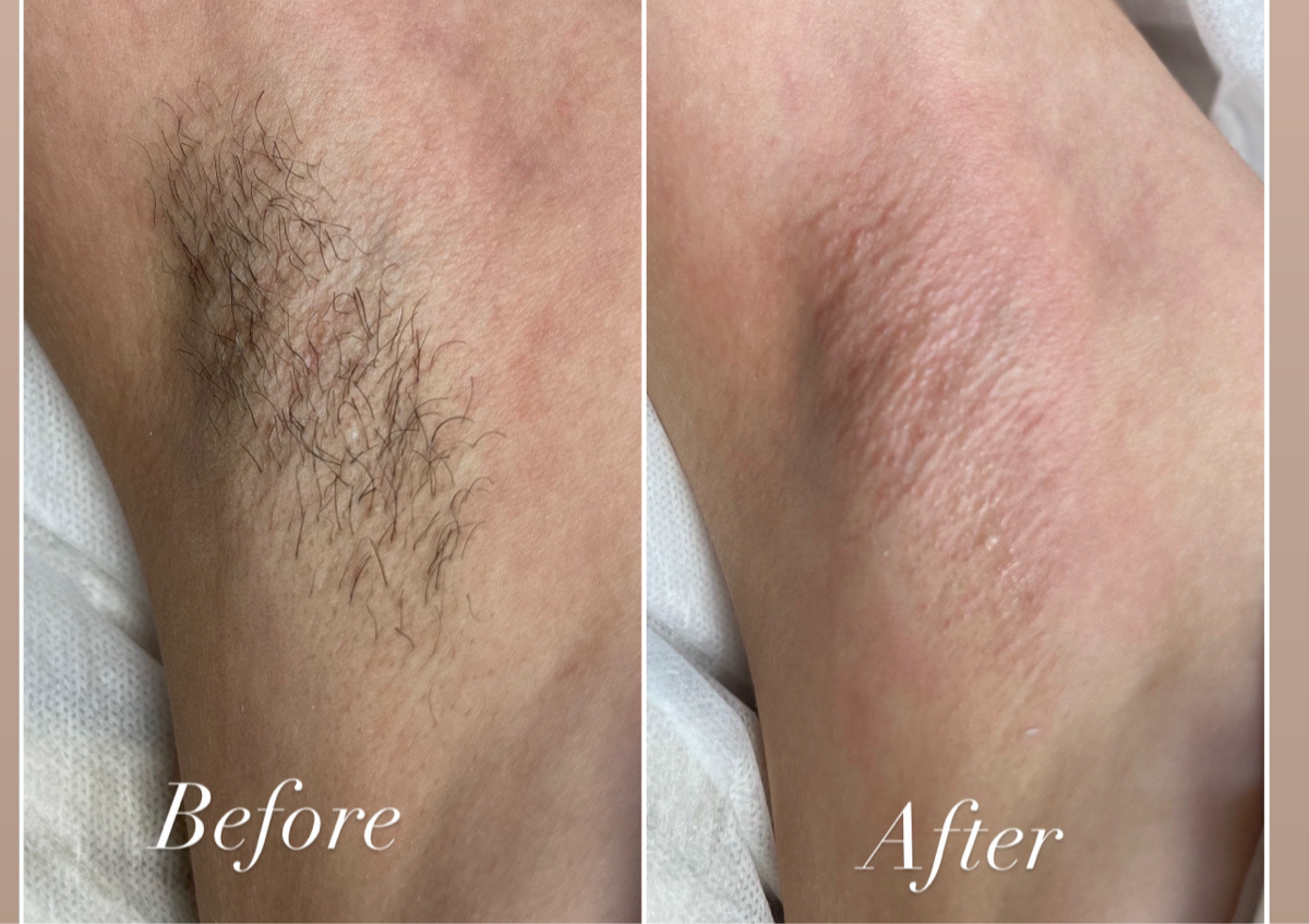 Under Arm Wax (Dm to book this service)