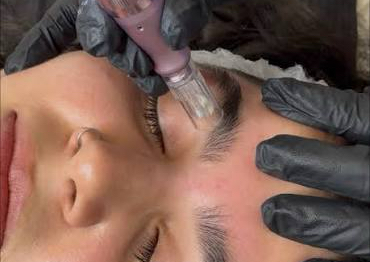Brow Growth