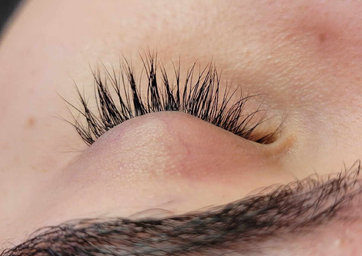 Remoción de extensiones