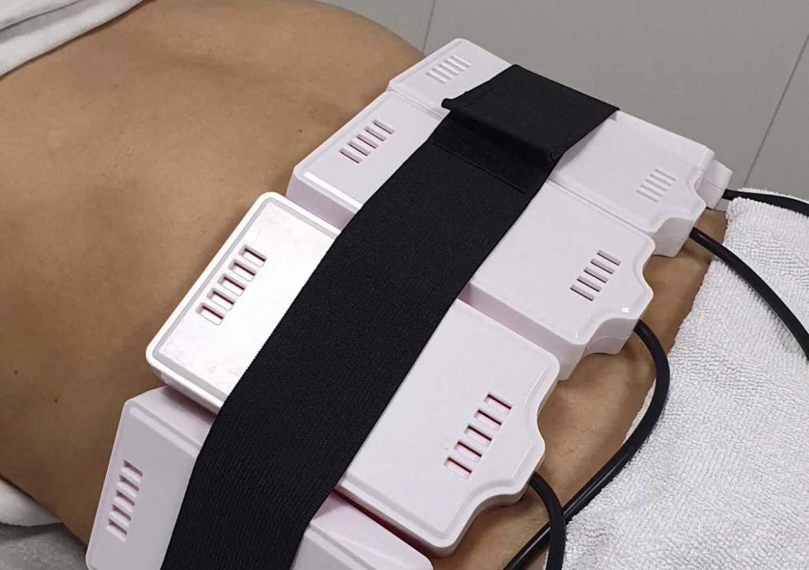 Lipolaser 1 area 1 sesion 