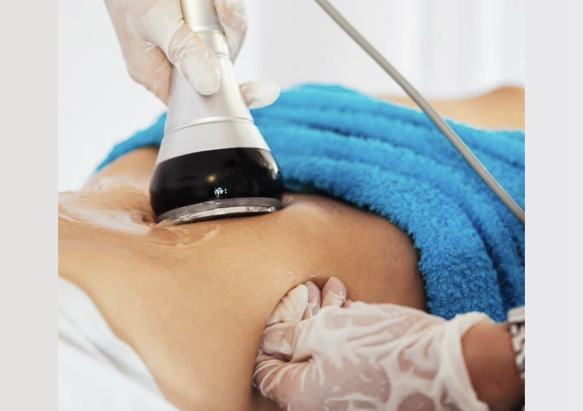 Cavitacion 1 sesion 1 area 