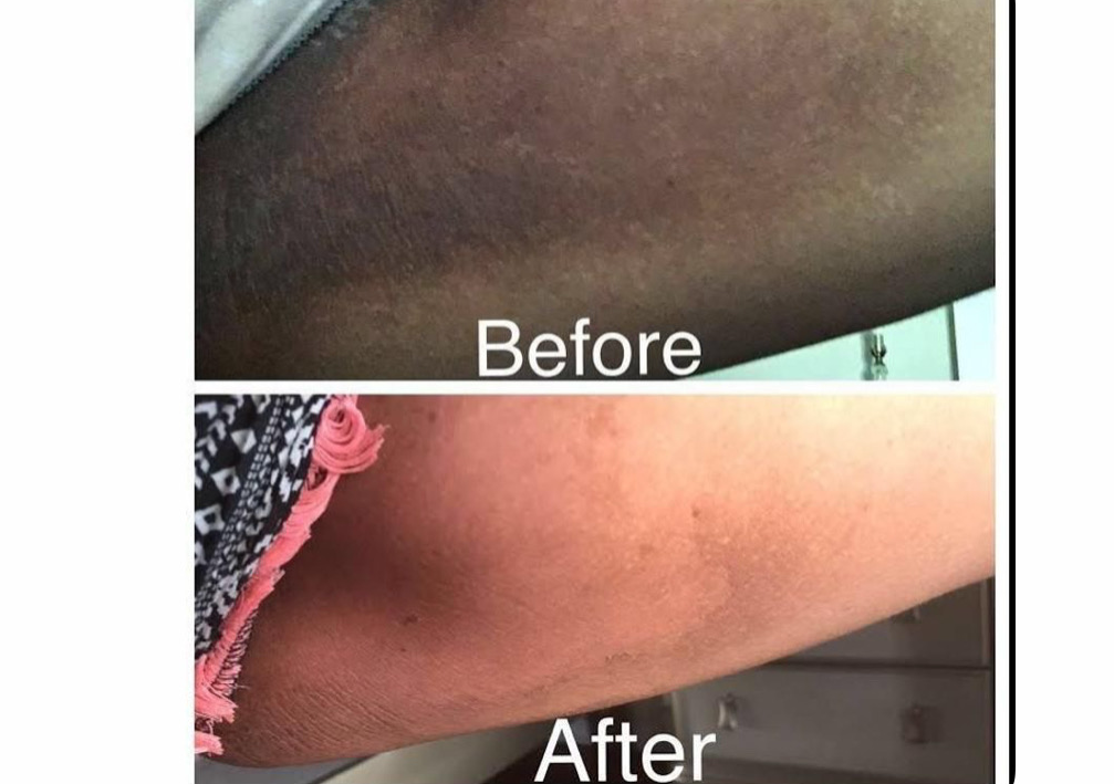 Inner Thighs Intimate Brightening 