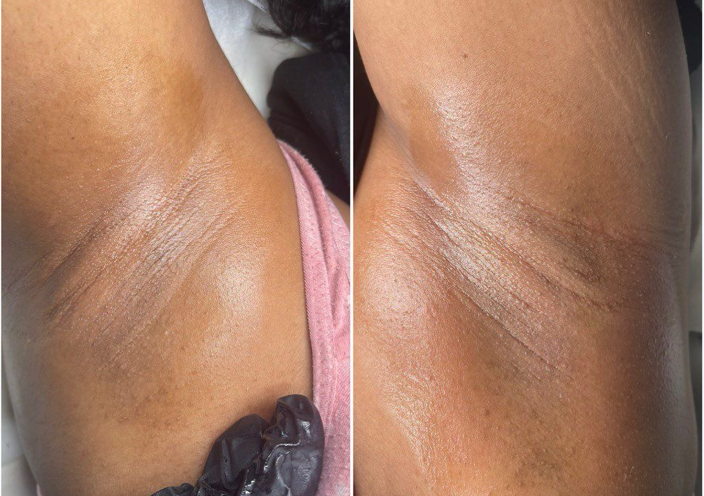 Underarm Wax 
