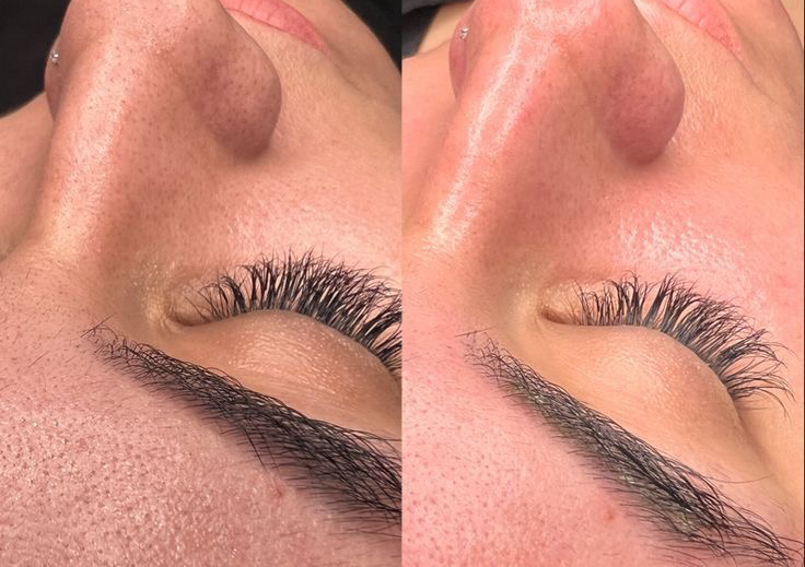 Clinically Customized Facial Treatment 