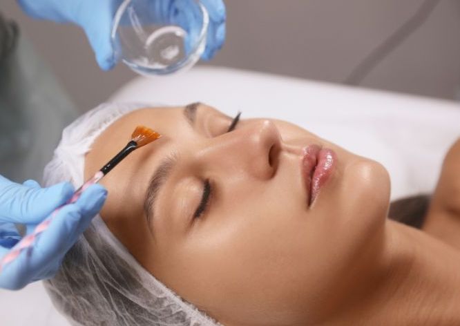Chemical Peel