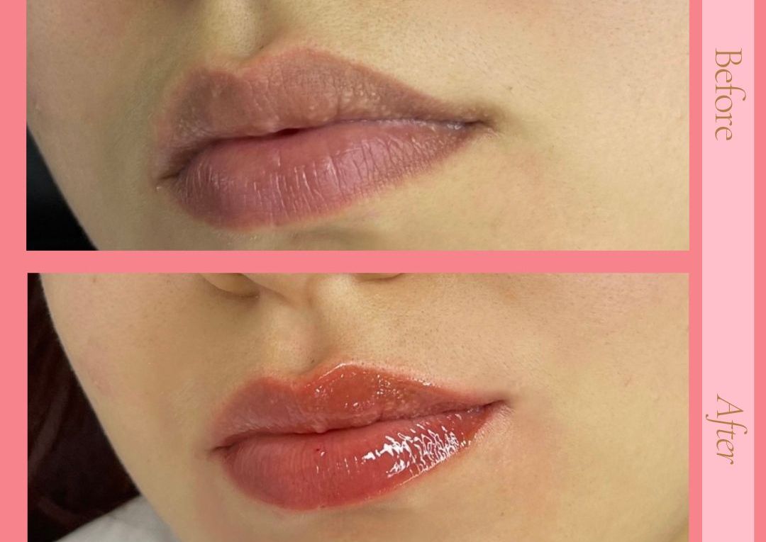 Hydra Lips