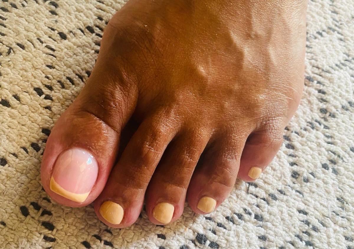 Gel Polish Toes