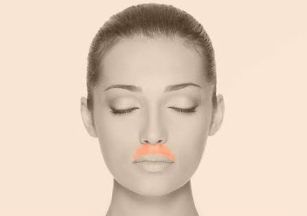 Upper lip & Chin