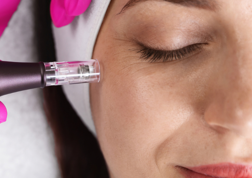 Microagujas ( Microneedles)