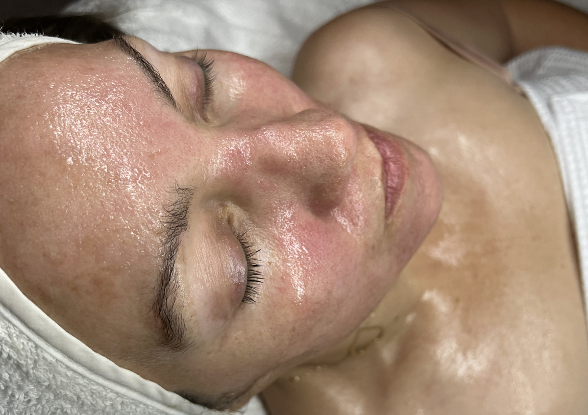 Facial Personalizado 