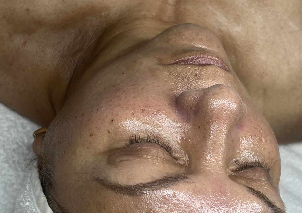 Facial Limpieza Profunda