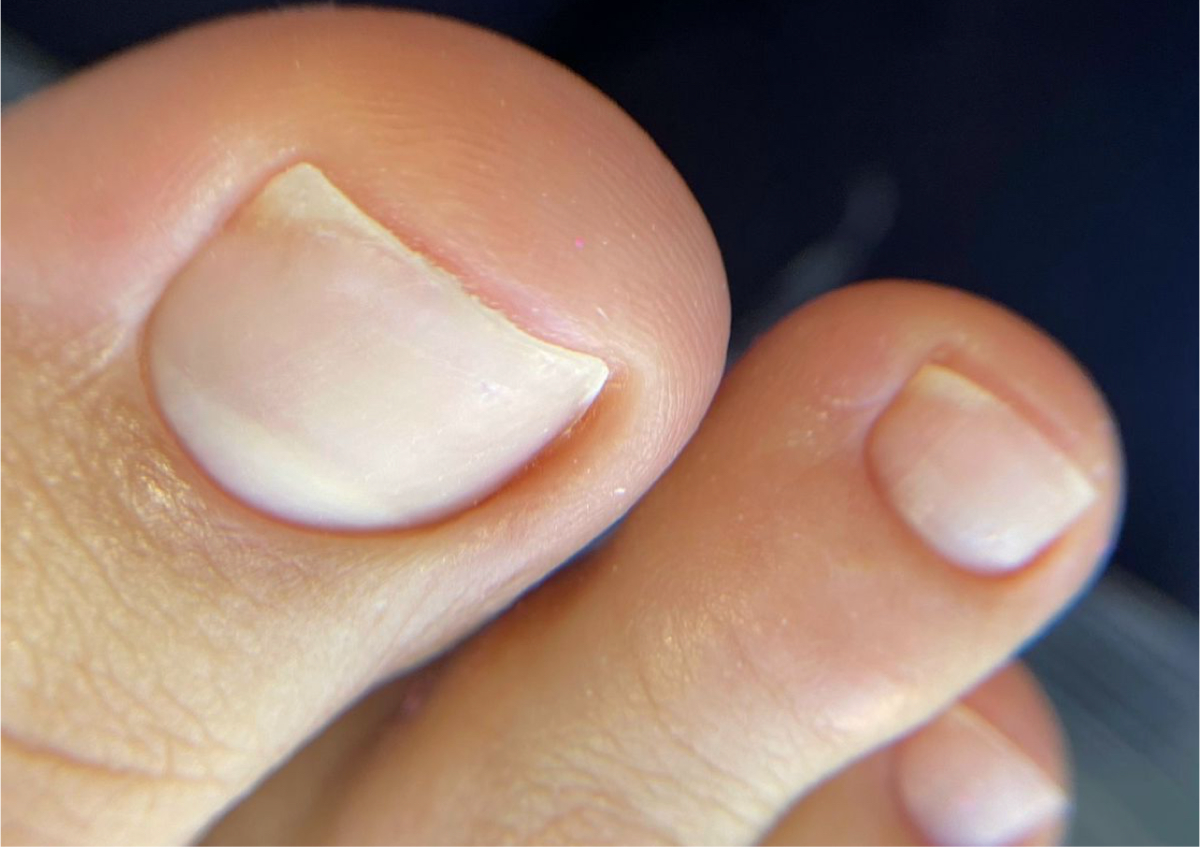 Just Pedicure