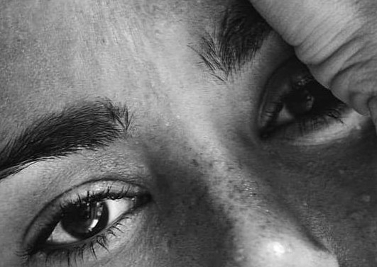 Fibroblast Entrecejo