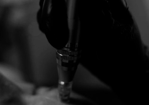 Facial + Microneedling Tx Secuelas de Acné