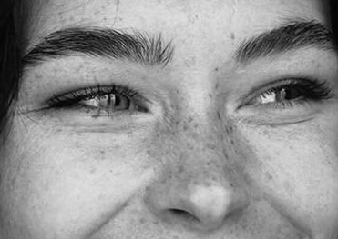 Fibroblast Patas de Gallo