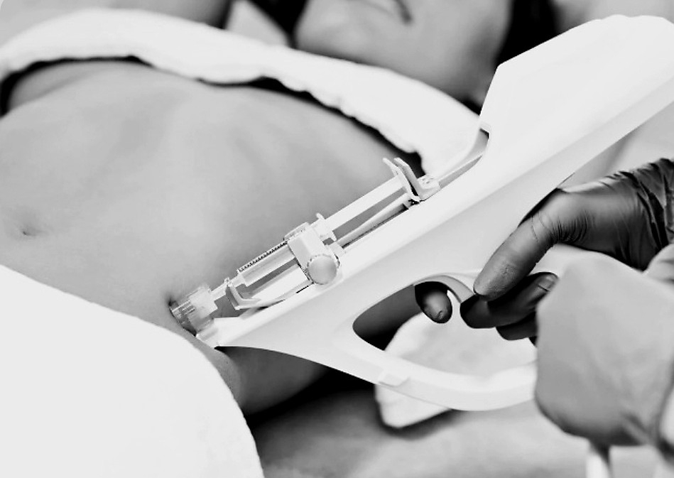 Lipo Flat Abs Abdomen