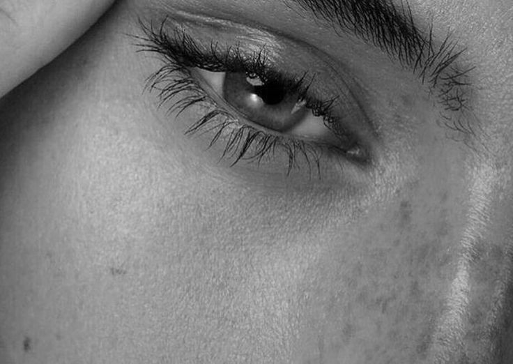 Fibroblast Párpado Superior