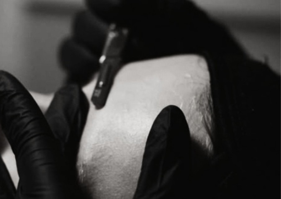 Facial + Dermaplaning