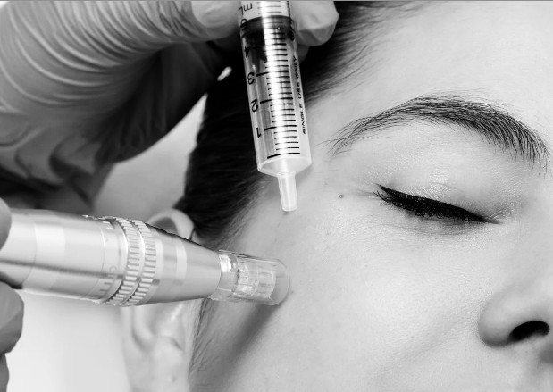 PRP Cara + Cuello + Escote