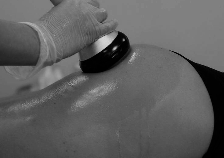 Lipotransferencia sin Bisturí