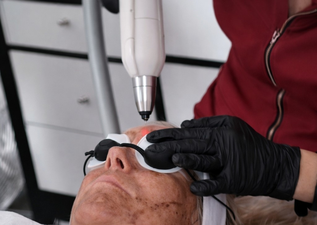 Carbon Laser Renewal