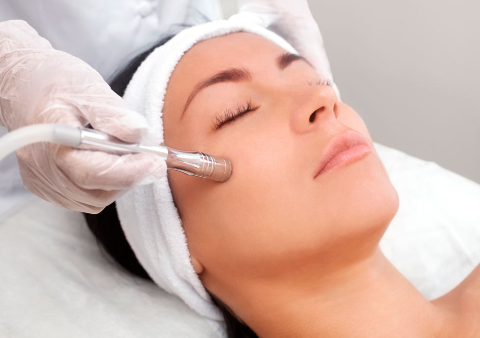 Microdermabrasion 