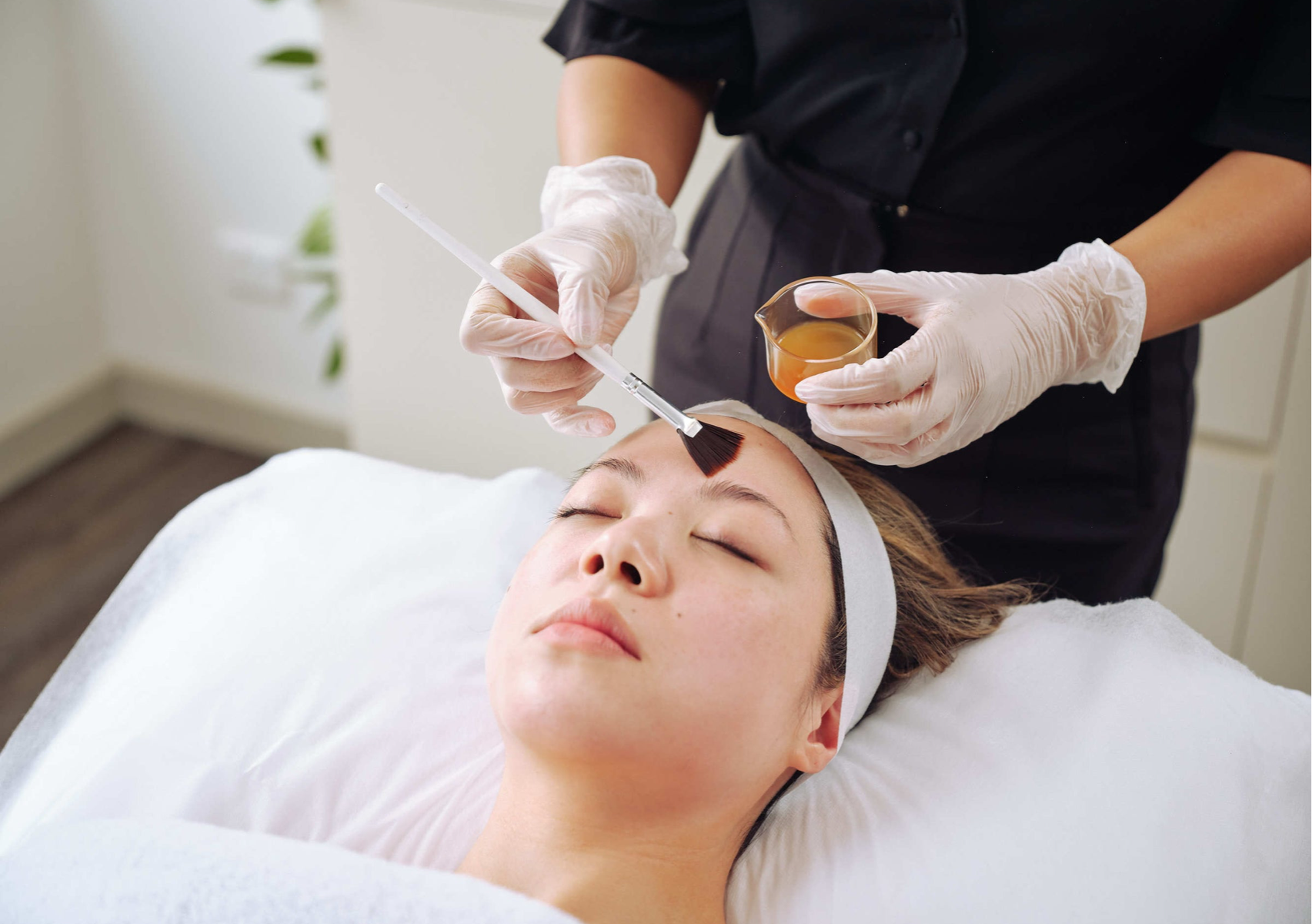 Peelings lijeros, medianos , profundos 