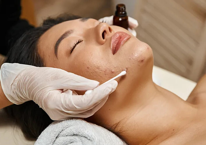 Facial antiacné con extraccion 