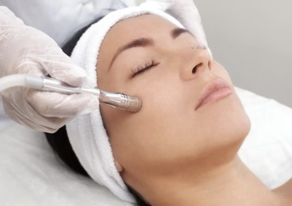 Diamond Peel 