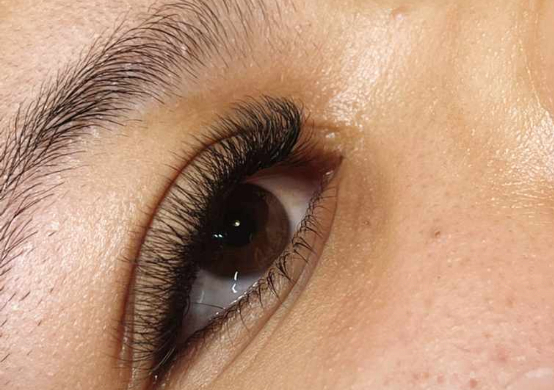 Retoque soft volumen