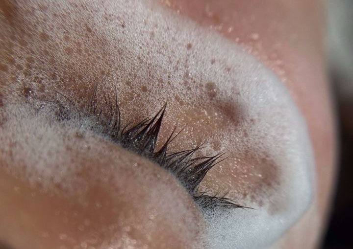 Lash removal with a New Set