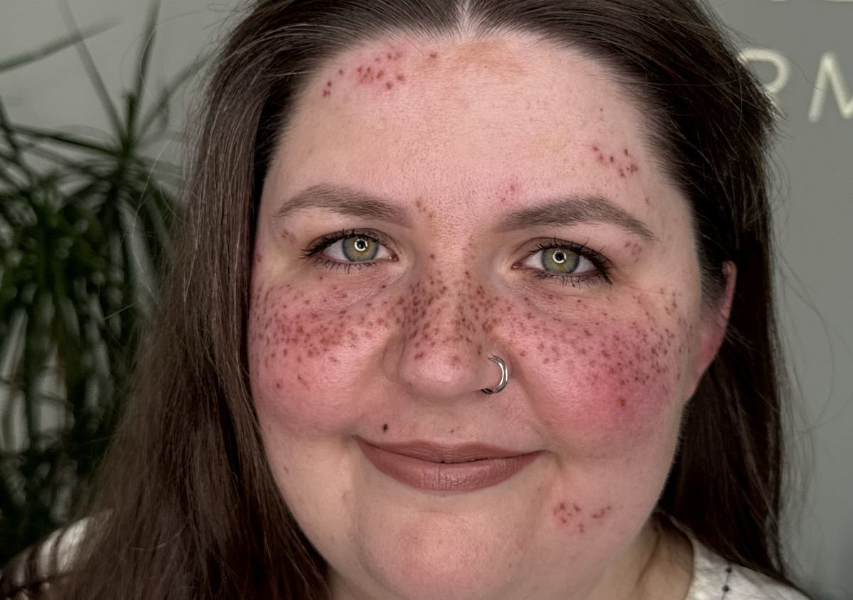 Freckles (Full Face)