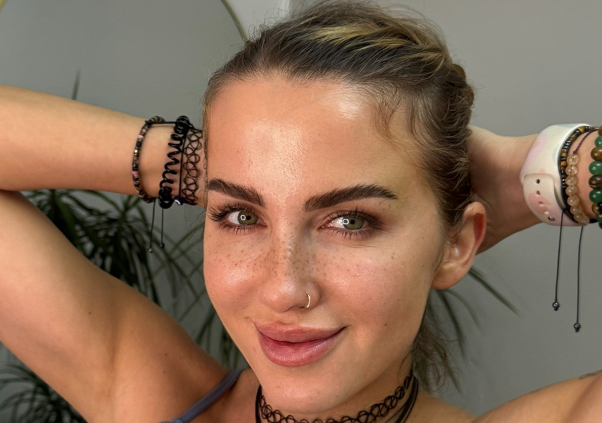 Freckles 