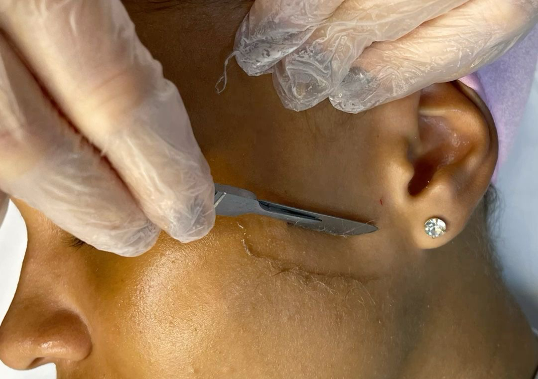 Express Dermaplaning 