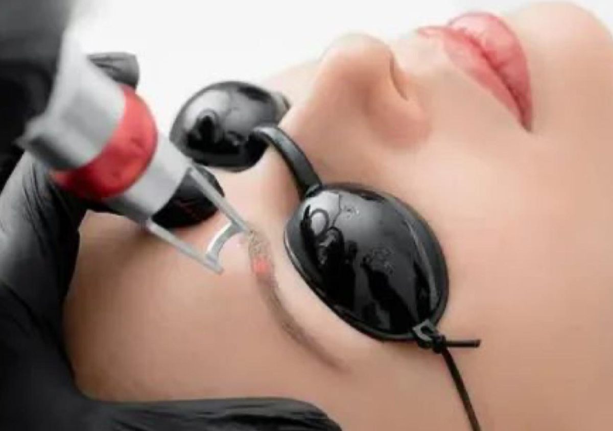 Remocion de tatuaje/micropigmentacion de cejas 