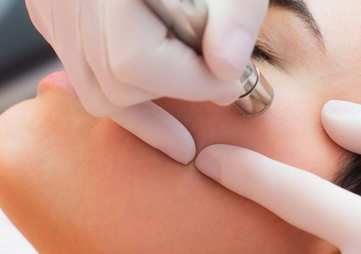 Lemarie Deep Glow Facial (Microdermoabrasión) ✨