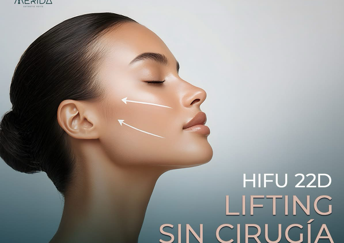 Oferta* HIFU 25D “Lifting sin cirugía” Rostro, Cuello, Papada, Escote y Parpados