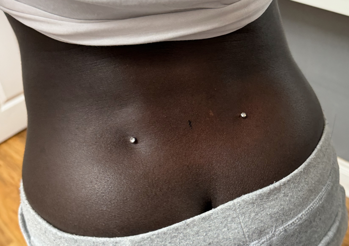 Back Dermal (pair)
