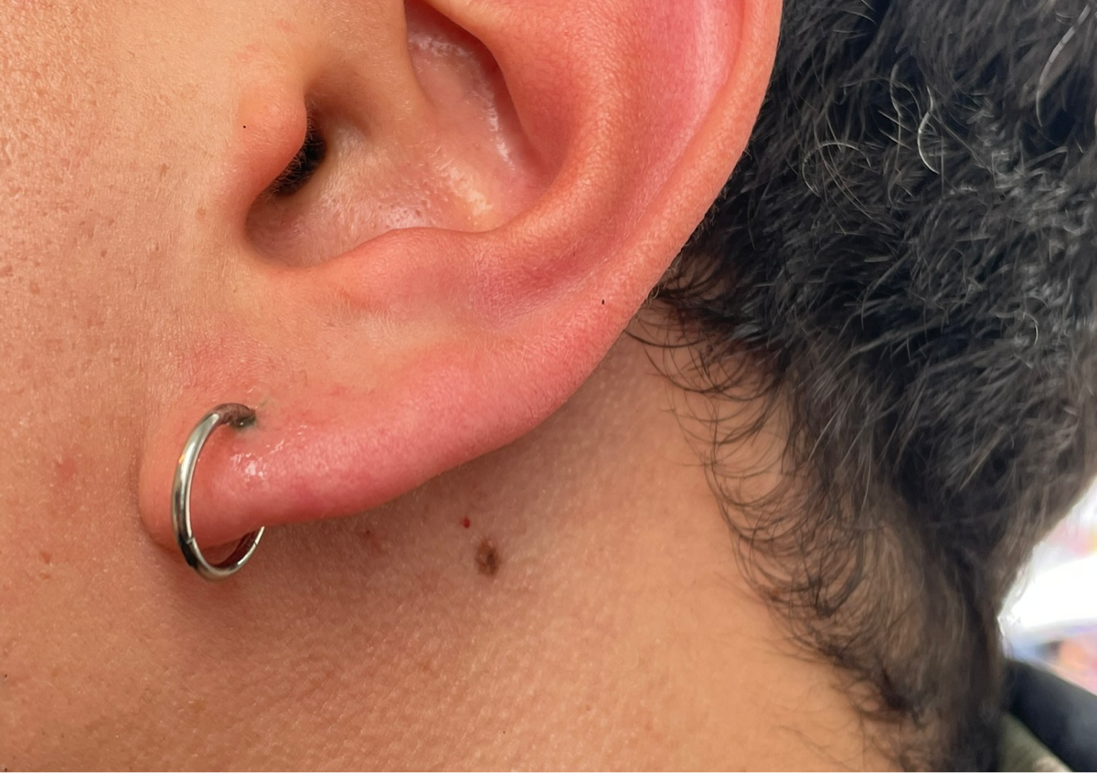 Lobe single(offer £20 was £25)