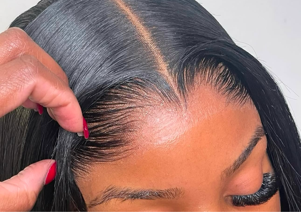 FRONTAL INSTALLATION 