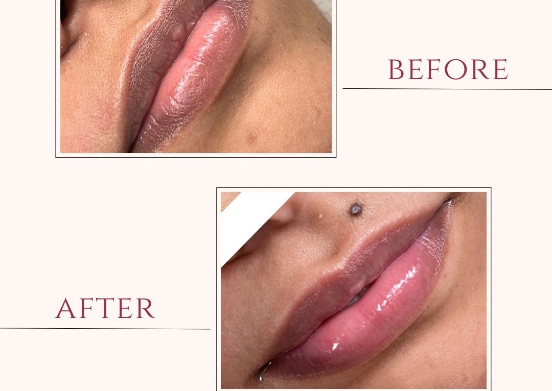 Hidratación de labi6